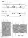 Fig. 02 - Braided textile sleeve with integrated opening and self-sustaining expanded and contracted states and method of construction thereof