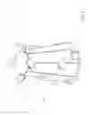 Fig. 05 - ACCESSORY FOR EXCAVATION OF A DITCH AND RELATED METHODS