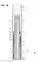 Fig. 02 - Gripping tool for removing a section of casing from a well