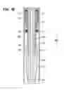 Fig. 03 - Gripping tool for removing a section of casing from a well