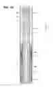Fig. 06 - Gripping tool for removing a section of casing from a well