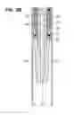 Fig. 07 - Gripping tool for removing a section of casing from a well