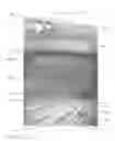 Fig. 01 - Decoupled seafloor mining system
