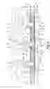 Fig. 05 - Cylinder head assembly for reciprocating compressor