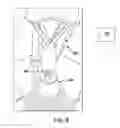 Fig. 09 - HYDRAULIC PUMP SYSTEMS