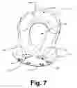 Fig. 08 - Clevis mount thimble