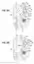 Fig. 09 - Valve assembly