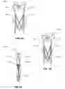 Fig. 04 - COLLAPSIBLE GUN STAND