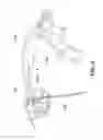 Fig. 07 - ARCHERY BOW WITH TWIN FLEX LIMB