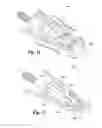 Fig. 07 - Broadhead retaining clip