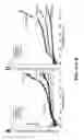 Fig. 15 - Apparatus and methods for optical coherence tomography and two-photon luminescence imaging