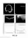 Fig. 18 - Apparatus and methods for optical coherence tomography and two-photon luminescence imaging