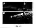 Fig. 21 - Apparatus and methods for optical coherence tomography and two-photon luminescence imaging