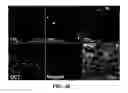 Fig. 22 - Apparatus and methods for optical coherence tomography and two-photon luminescence imaging