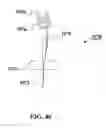 Fig. 52 - Bodily fluid sample collection and transport