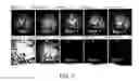 Fig. 06 - Method for reduction of autofluorescence from biological samples