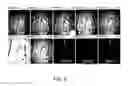 Fig. 07 - Method for reduction of autofluorescence from biological samples