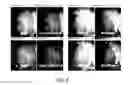 Fig. 09 - Method for reduction of autofluorescence from biological samples