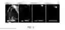 Fig. 10 - Method for reduction of autofluorescence from biological samples