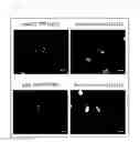 Fig. 10 - Method for determining a protein-protein interaction