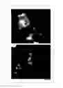 Fig. 29 - Method for determining a protein-protein interaction