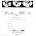Fig. 09 - Molecular analysis of tumor samples