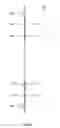 Fig. 10 - Test socket