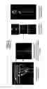 Fig. 02 - Method and magnetic resonance apparatus for maxwell compensation in simultaneous multislice data acquisitions