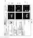 Fig. 12 - SYSTEMS FOR IMAGING WITH MULTI-HEAD CAMERA