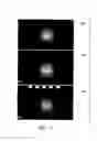 Fig. 15 - SYSTEMS FOR IMAGING WITH MULTI-HEAD CAMERA