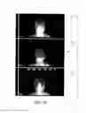 Fig. 16 - SYSTEMS FOR IMAGING WITH MULTI-HEAD CAMERA