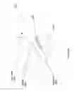 Fig. 33 - Suppression of stray light in head worn computing