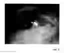 Fig. 05 - Continuous autofocusing eyewear