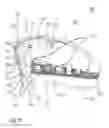 Fig. 33 - Multi-surface controller