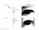 Fig. 01 - Hand-attachable wearable device capable of iris recognition indoors and/or outdoors