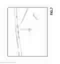 Fig. 08 - Image processing method for detecting objects using relative motion