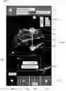 Fig. 01 - METHOD AND SYSTEM FOR MEASURING A VOLUME FROM AN ULTRASOUND IMAGE
