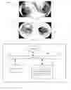 Fig. 06 - Rendering expanded lumen image