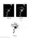 Fig. 04 - Angiographic roadmapping mask