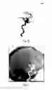 Fig. 06 - Angiographic roadmapping mask