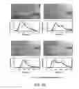 Fig. 08 - SYSTEMS AND METHODS FOR MEDICAL IMAGE SEGMENTATION AND ANALYSIS