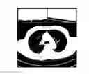Fig. 01 - Topological derivative-based image segmentation method and system with heterogeneous image features