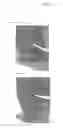 Fig. 25 - System and method for multiple feature detection and analysis of a rotating tire