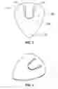 Fig. 02 - Guitar pick