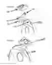 Fig. 23 - Acoustic-to-electronic bass drum conversion kit