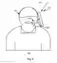 Fig. 05 - Method and device for suppressing ambient noise in a speech signal generated at a microphone of the device