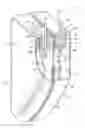 Fig. 01 - HIGH VOLTAGE DUAL ANODE TANTALUM CAPACITOR WITH FACING CASING CLAMSHELLS CONTACTING AN INTERMEDIATE PARTITION