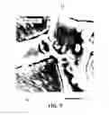 Fig. 10 - Electronic device, electronic part, and solder