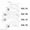 Fig. 07 - Catch flexure systems, devices and methods
