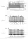 Fig. 07 - ESD-protective-function-equipped composite electronic component